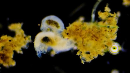 超级镜头：神奇的微生物 8集