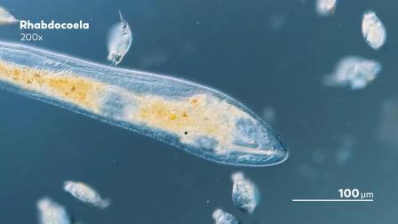 超级镜头：神奇的微生物 3集