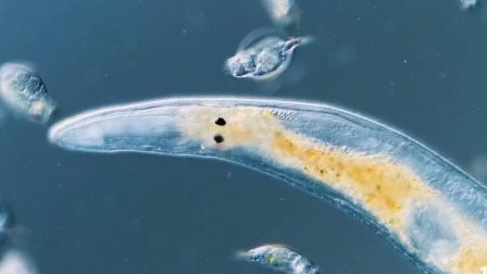 超级镜头：神奇的微生物 4集